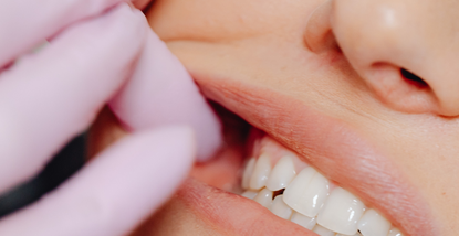 Kućna njega za zdrave desni - dnevne rutine za održavanje zdravlja desni