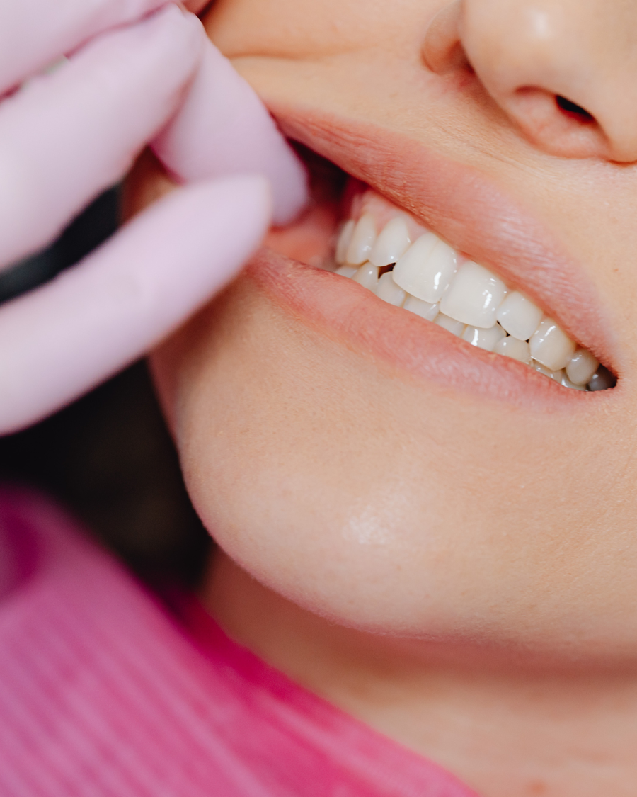 Kućna njega za zdrave desni - dnevne rutine za održavanje zdravlja desni