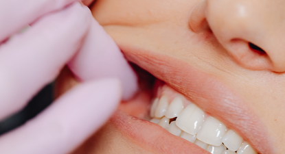 Kućna njega za zdrave desni - dnevne rutine za održavanje zdravlja desni