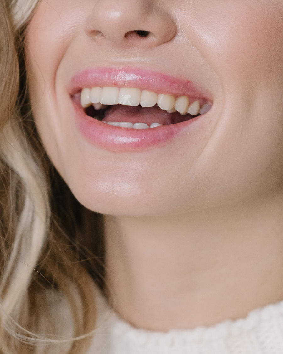 Kako oblikovanje zubnog mesa može uljepšati vaš osmijeh?